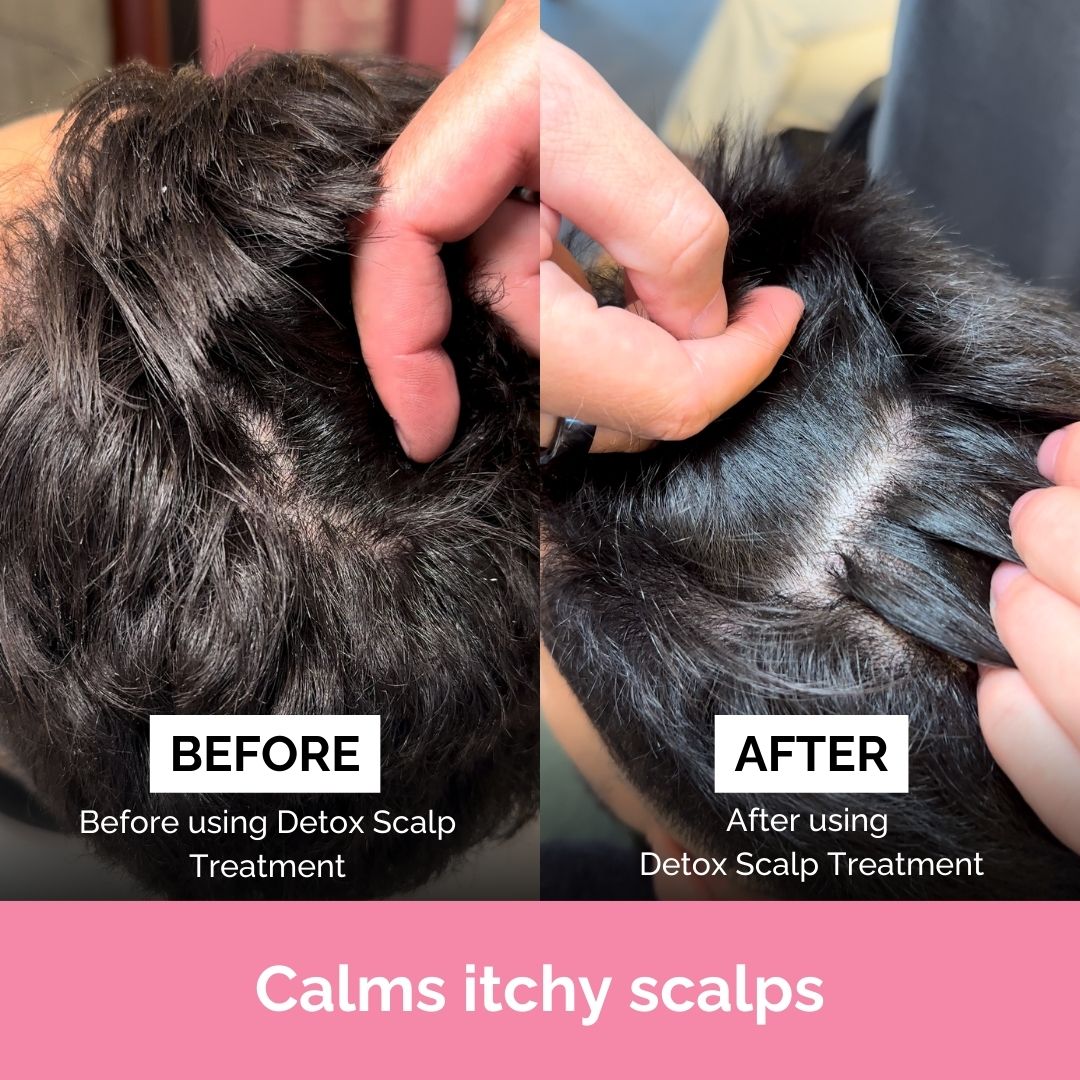 FUL Detox Scalp Treatment 150ml– Relief for Dry, Flaky or Itchy Scalps | Clarifying & Hydrating - Image 6